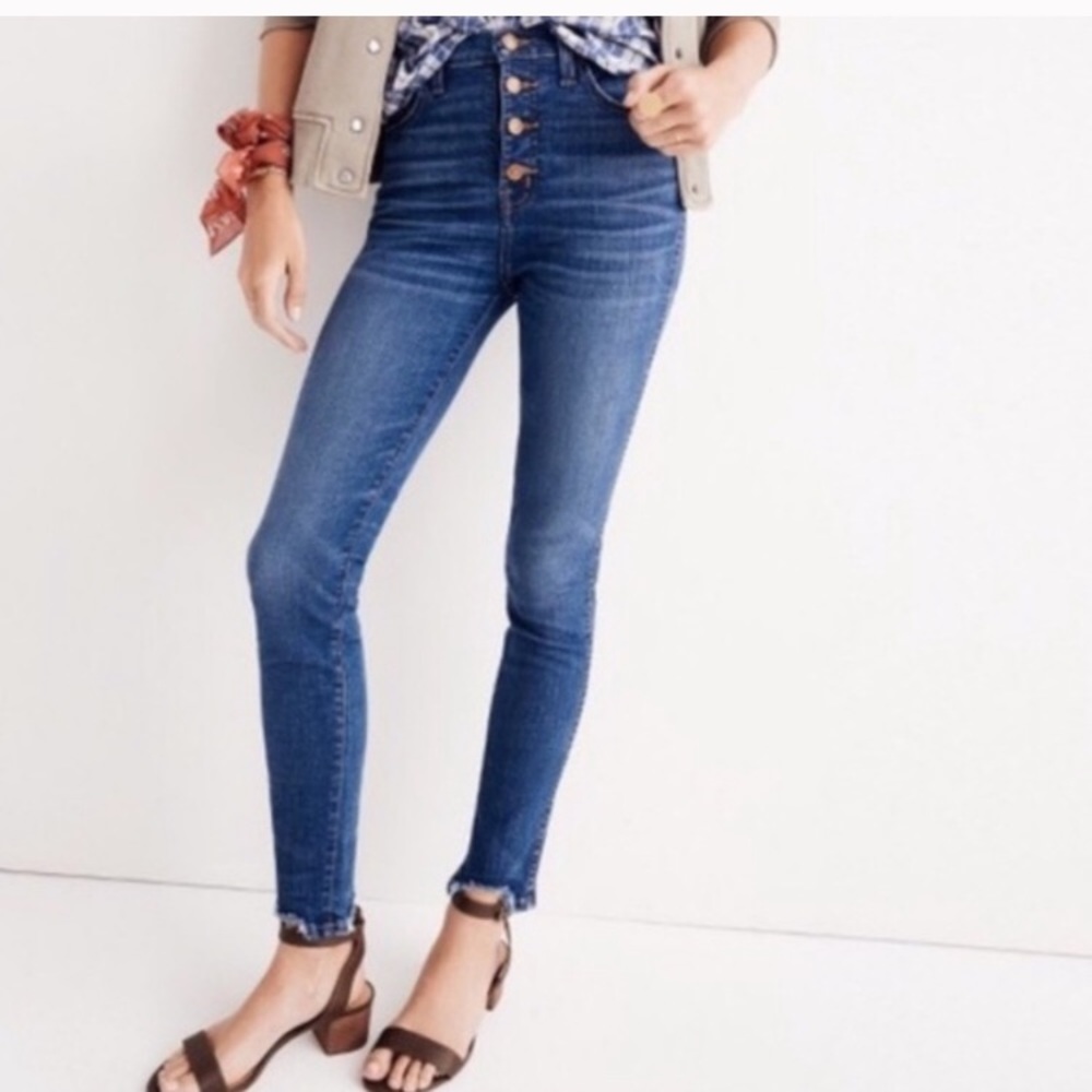 Madewell Button Fly High Riser 10” Skinny Jeans
